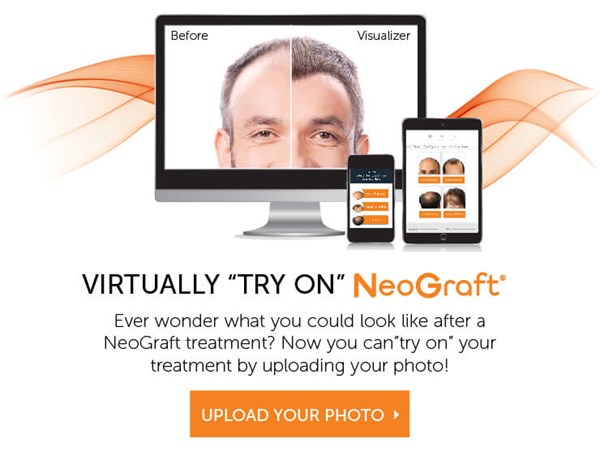NeoGraft