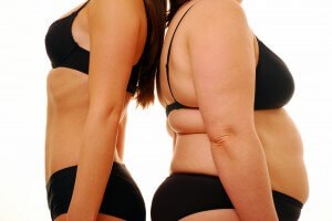 Obesity Photo