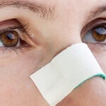 post op rhinoplasty tips post op rhinoplasty
