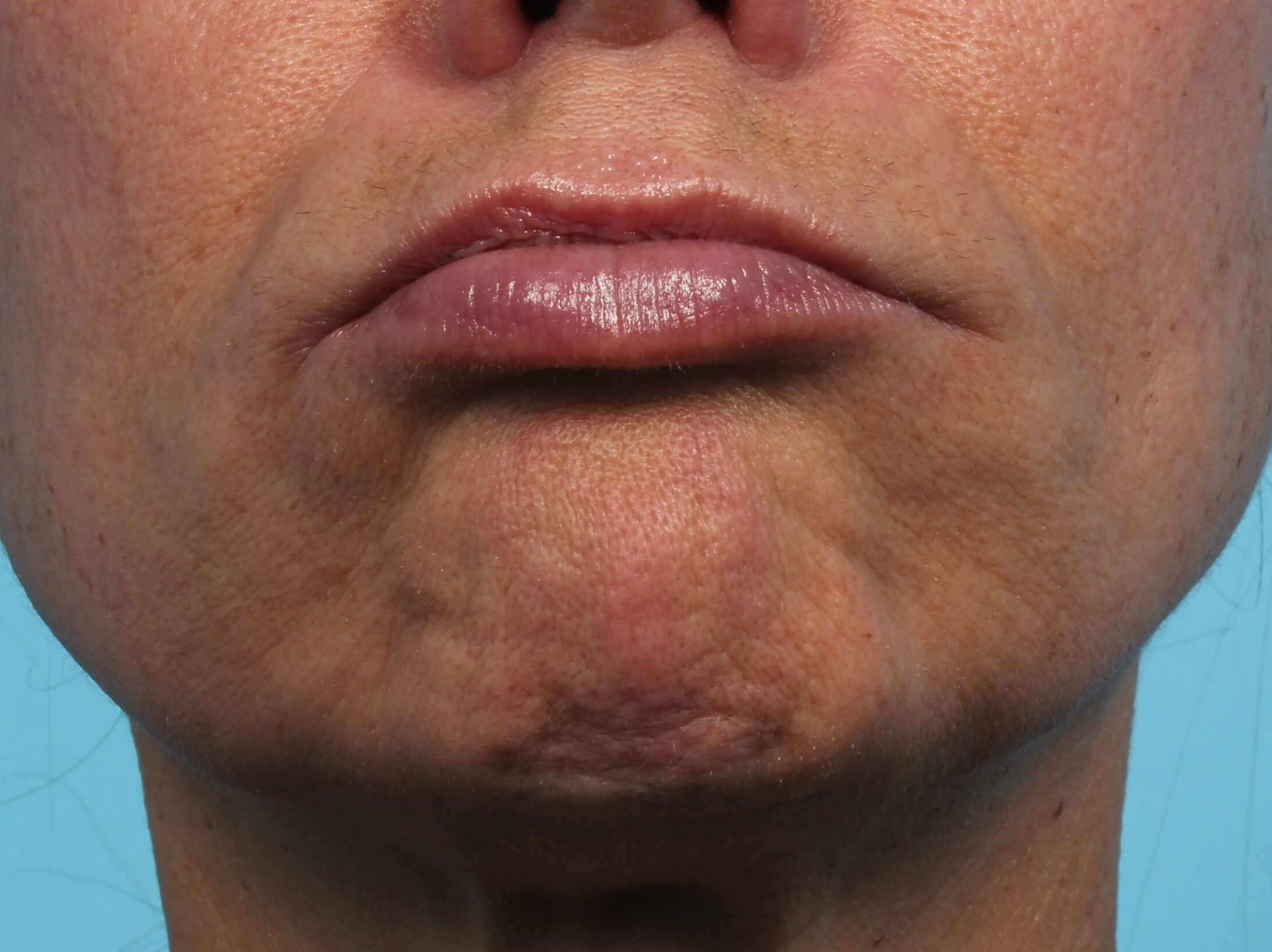 Being Nice Can Be Good For Your Health. 2 Image result for frown mouth