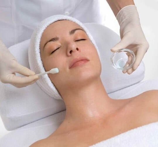 getlaserruislip.co_.uk-Chemical-Peels-in-Ruislip-min