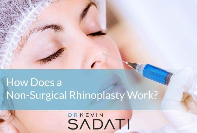 Non-Surgical-Rhinoplasty