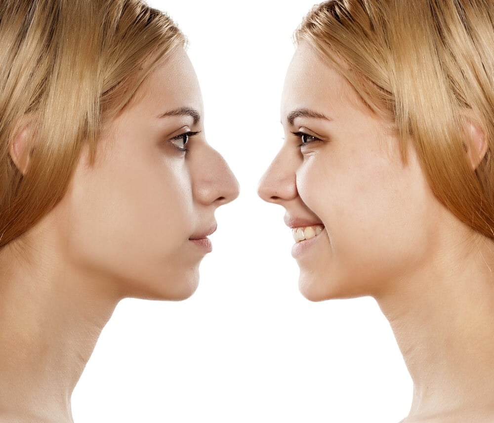 Facial Exercises To Change The Shape Of Your Nose 