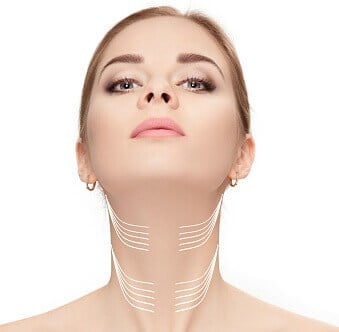 Neck Lift