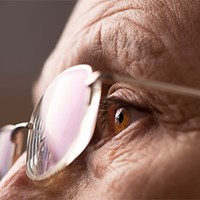Eyelid Surgery