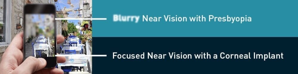 Blurry Vision